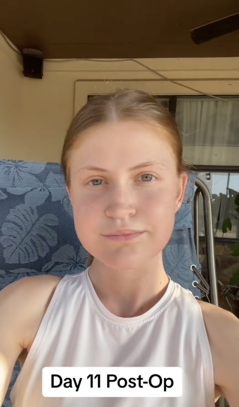 Virginia Elder aparece al aire libre el día 11 del postoperatorio, enmarcada por la luz del sol y con la mirada firme | Fuente: TikTok/virginiaeelder