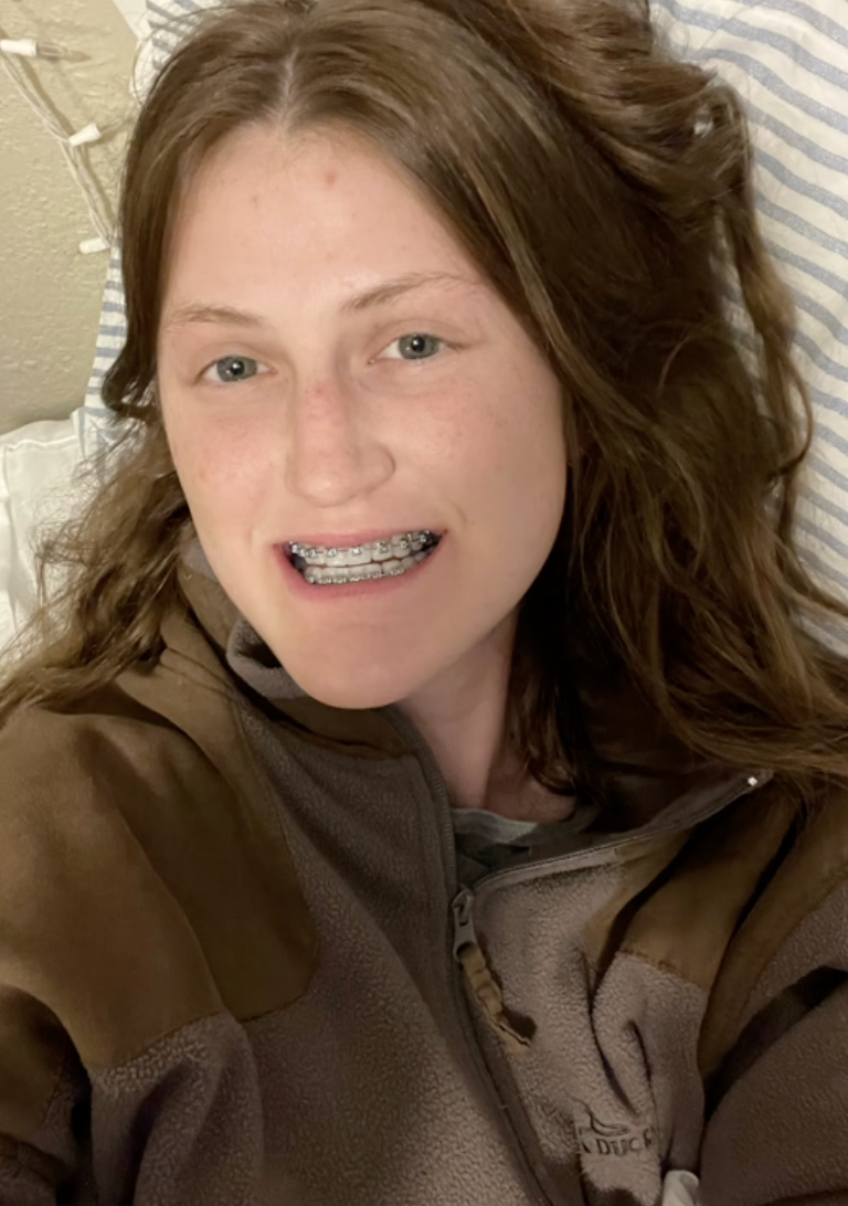 Antes de la operación, Virginia Elder sonríe con aparato, un paso visible en su larga transformación | Fuente: TikTok/virginiaeelder