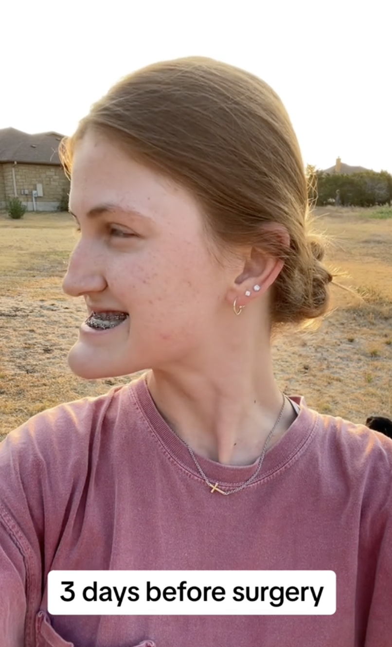 Con una amplia sonrisa, Virginia Elder deja entrever su perfil preoperatorio con ortodoncia | Fuente: TikTok/virginiaeelder