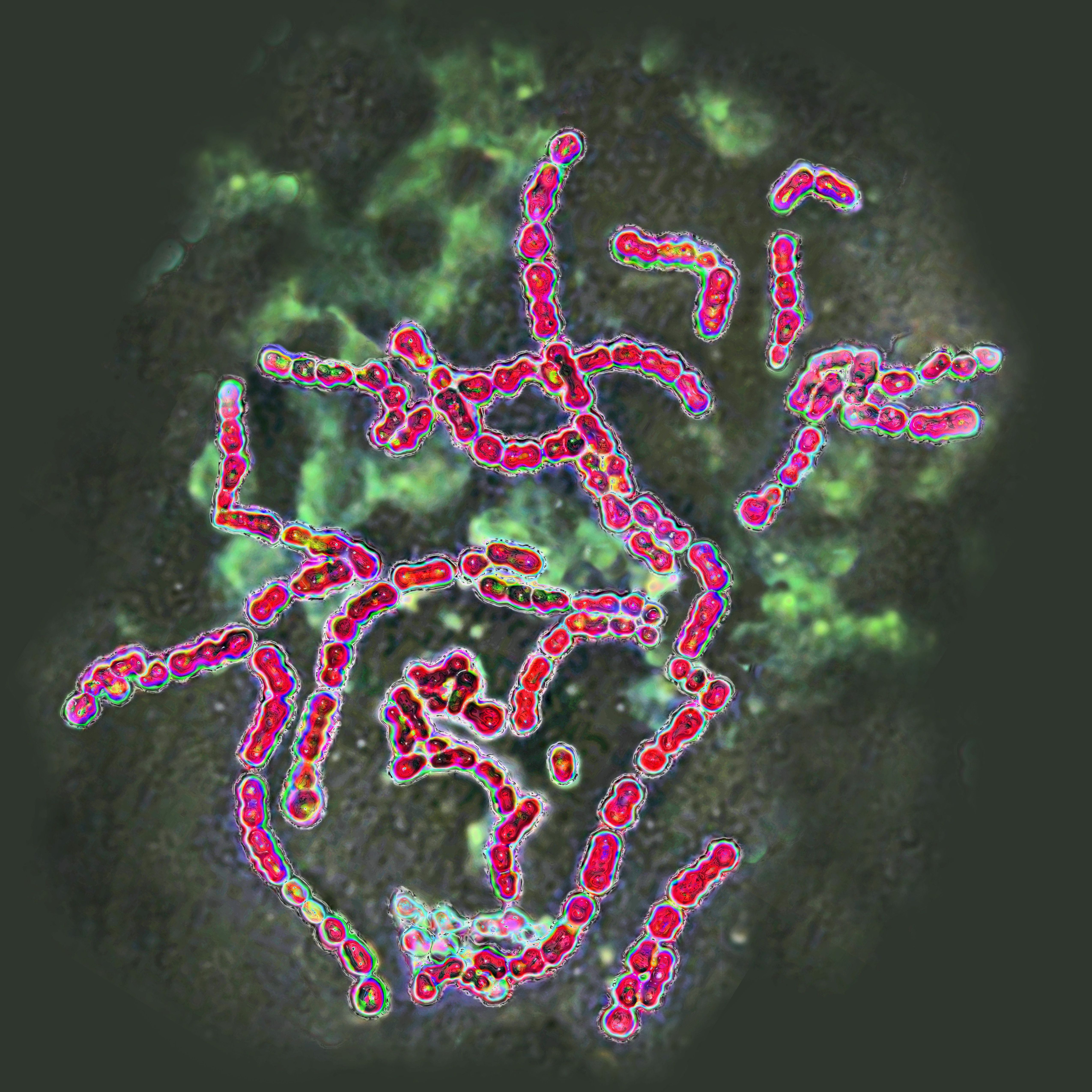 Imagen de Streptococcus pyogenes del grupo A | Fuente: Getty Images