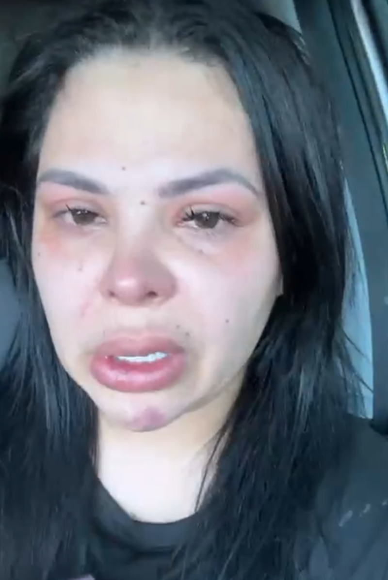 Fernanda Redondo denunciando a Rafael González por violencia | Fuente: TikTok/fergcortez