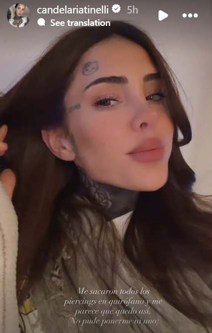 Cande Tinelli mostrando su look sin sus piercings tras pasar por el quirófano | Fuente: Instagram Stories/candelariatinelli