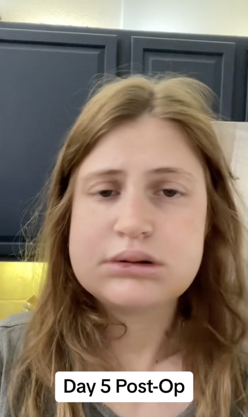 Virginia Elder de pie en su cocina el día 5 del postoperatorio, marcando la movilidad temprana | Fuente: TikTok/virginiaeelder