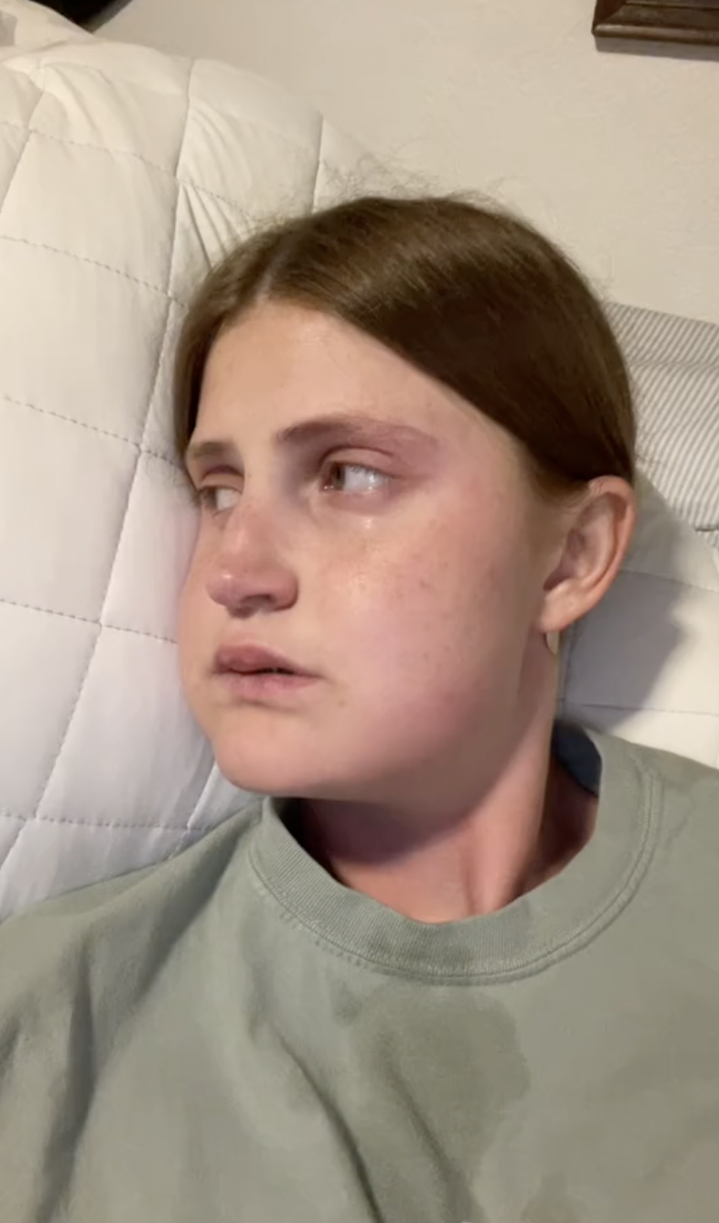 Todavía visiblemente hinchada y emocionada, Virginia Elder registra su tercer día de curación tras la operación | Fuente: TikTok/virginiaeelder