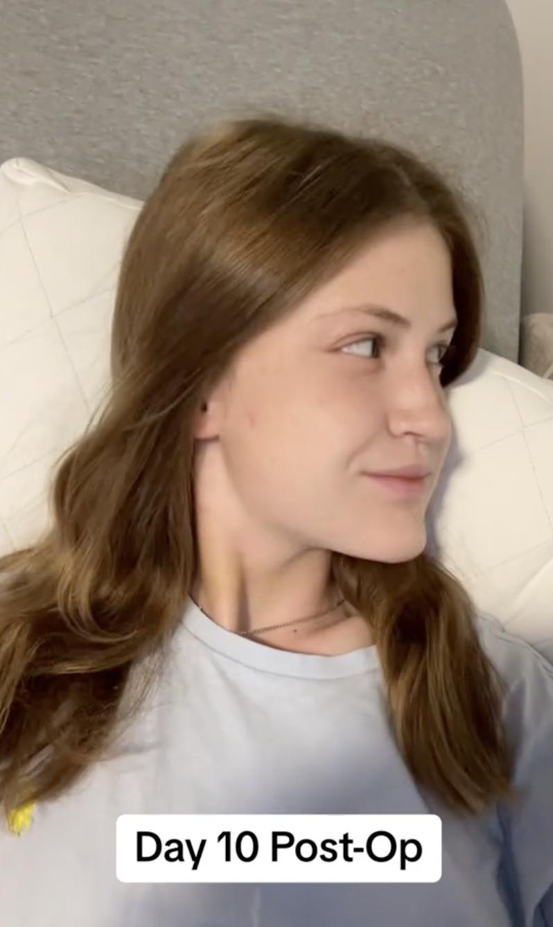 Tras diez días de recuperación, Virginia Elder ofrece una suave sonrisa mientras mira a un lado | Fuente: TikTok/virginiaeelder