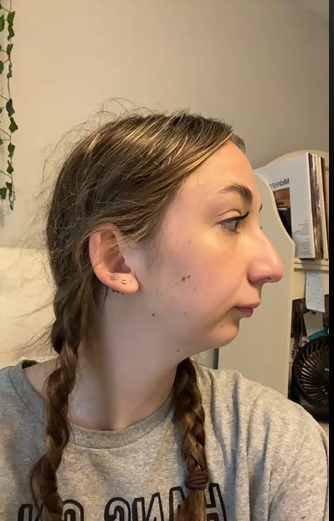 TikToker Maddie antes de someterse a una operación de doble mandíbula de un post fechado el 24 de octubre de 2023. | Fuente: TikTok/maddieakamofo