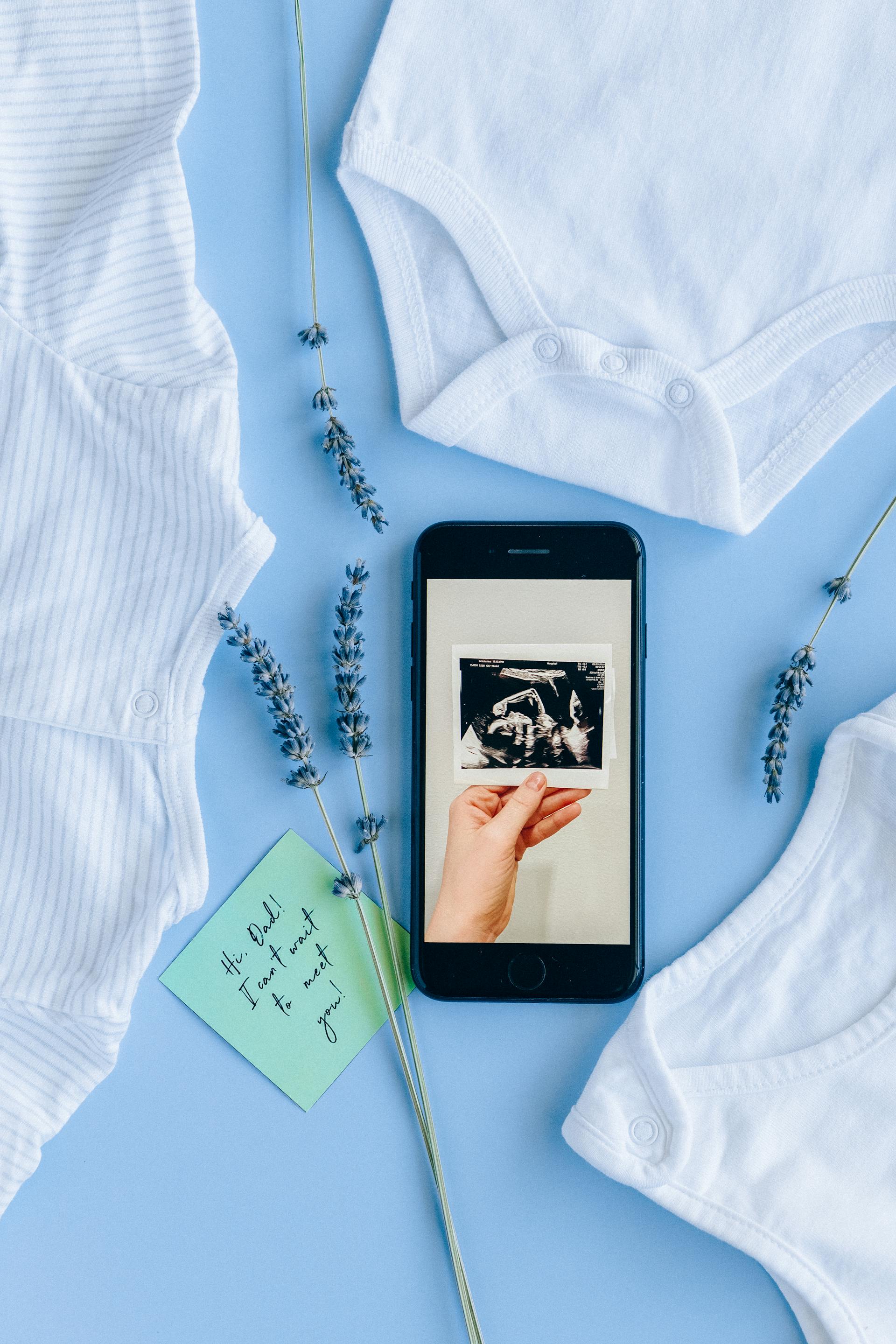 Una ecografía en la pantalla de un teléfono junto a ropa de bebé | Fuente: Pexels
