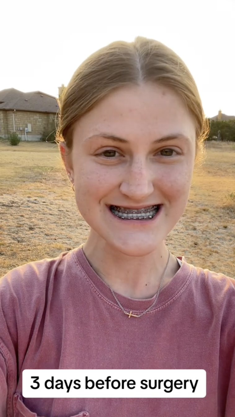 Mirando al frente, Virginia Elder sonríe con confianza tres días antes de la operación | Fuente: TikTok/virginiaeelder