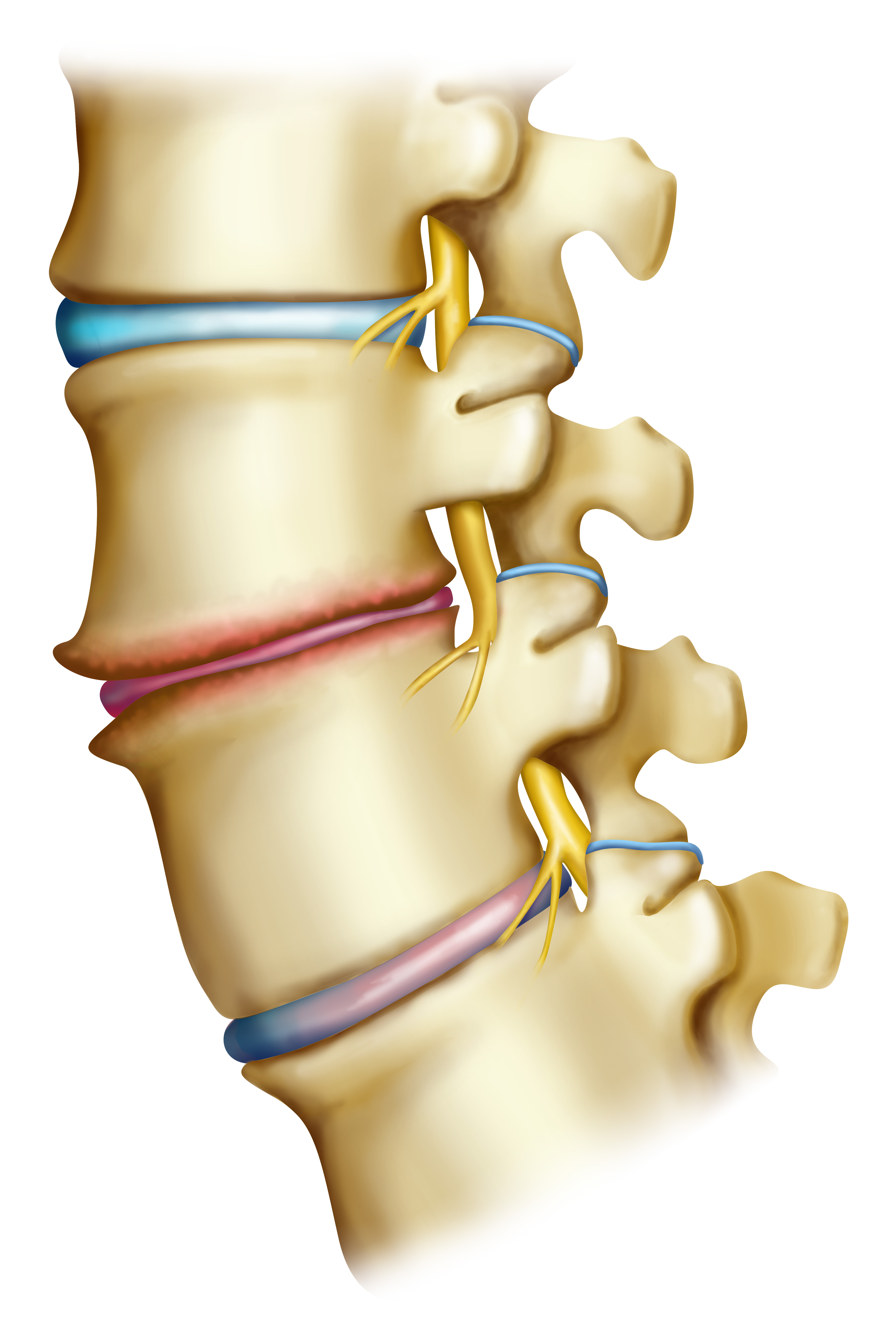 Columna lumbar que ilustra una degeneración vertebral | Fuente: Getty Images