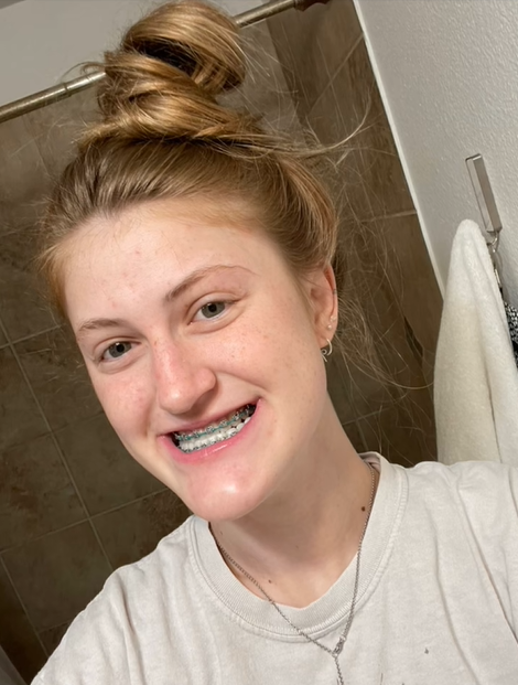 Virginia Elder comparte un selfie en el baño, sonriendo con aparatos durante las primeras etapas de su viaje de ortodoncia | Fuente: TikTok/virginiaeelder