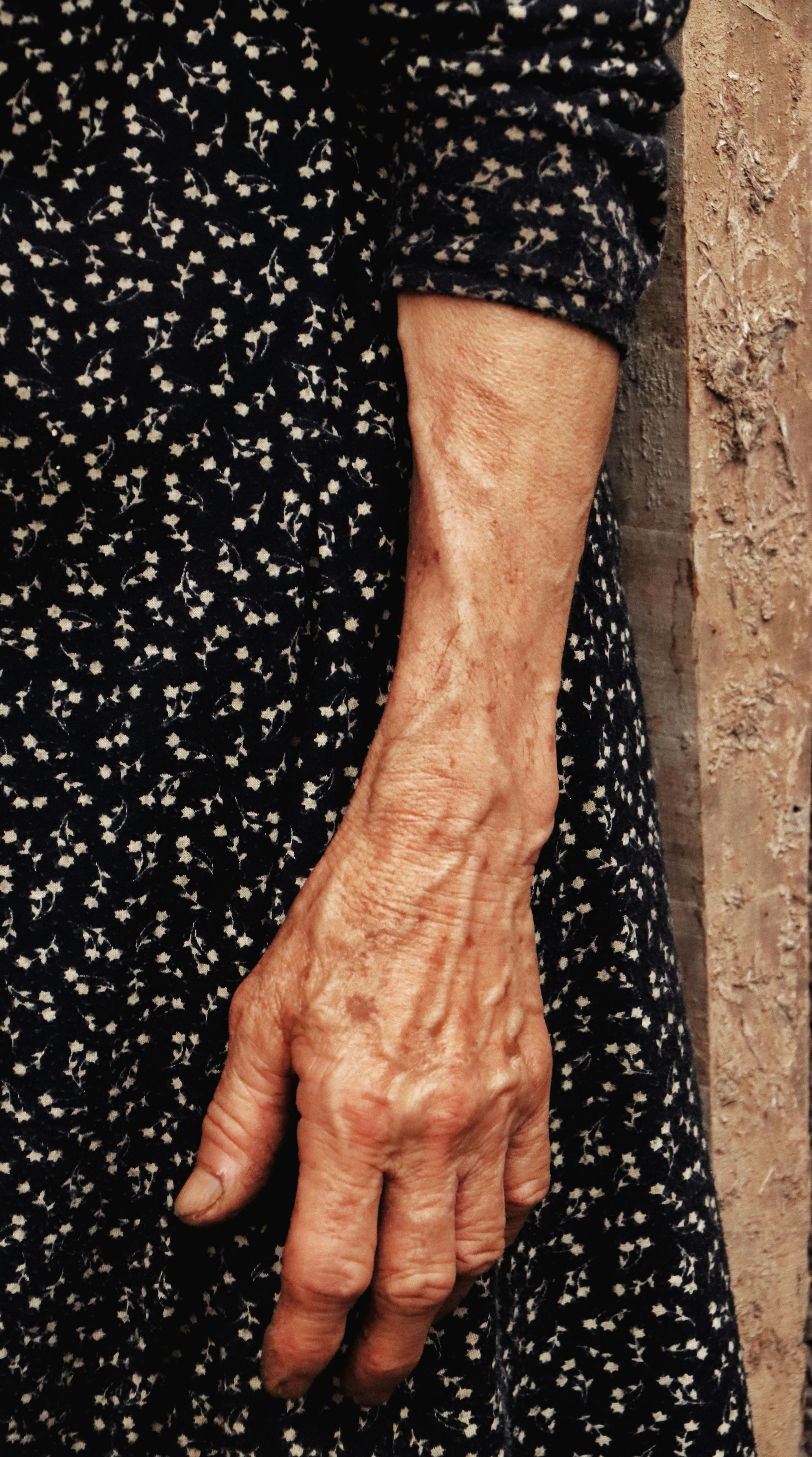 El brazo arrugado de una mujer | Fuente: Pexels