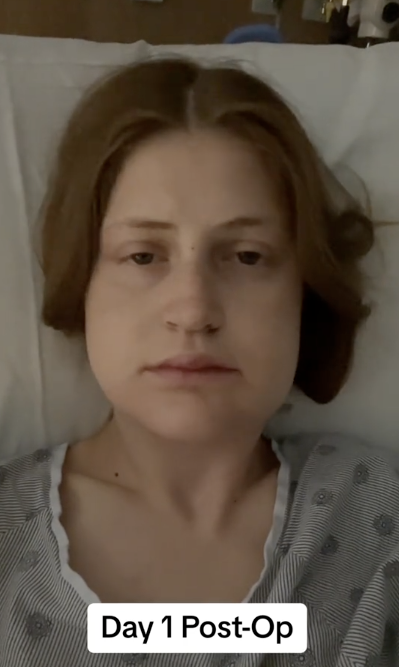 Todavía en el hospital, Virginia Elder se enfrenta a la cámara con una mirada hinchada e inexpresiva el primer día después de la operación | Fuente: TikTok/virginiaeelder