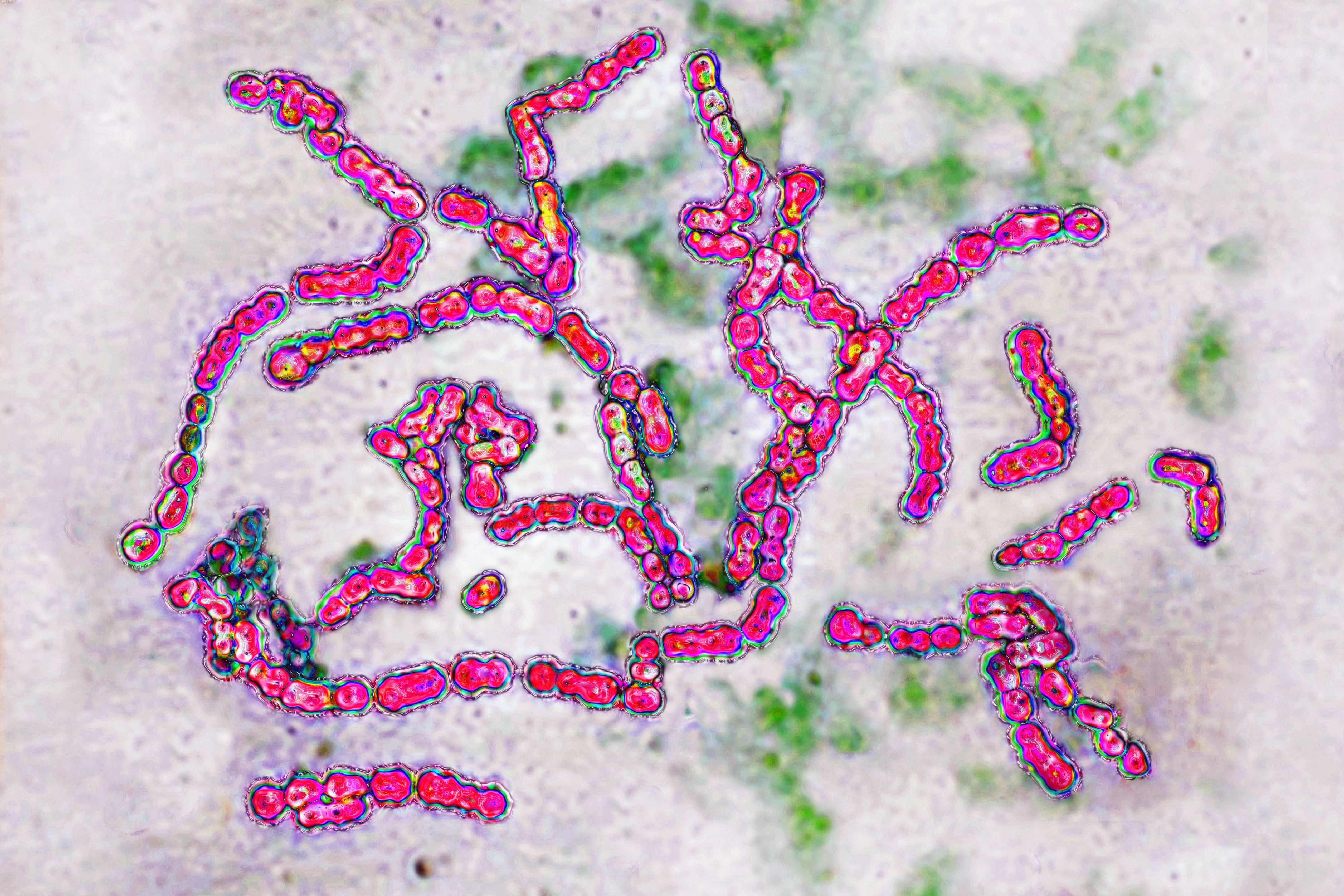 Streptococcus pyogenes del grupo A, la bacteria relacionada con la faringitis estreptocócica y otras infecciones | Fuente: Getty Images