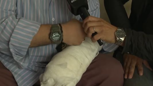 El brazo herido de Pablo, el hombre accidentado | Fuente: Instagram/americatv