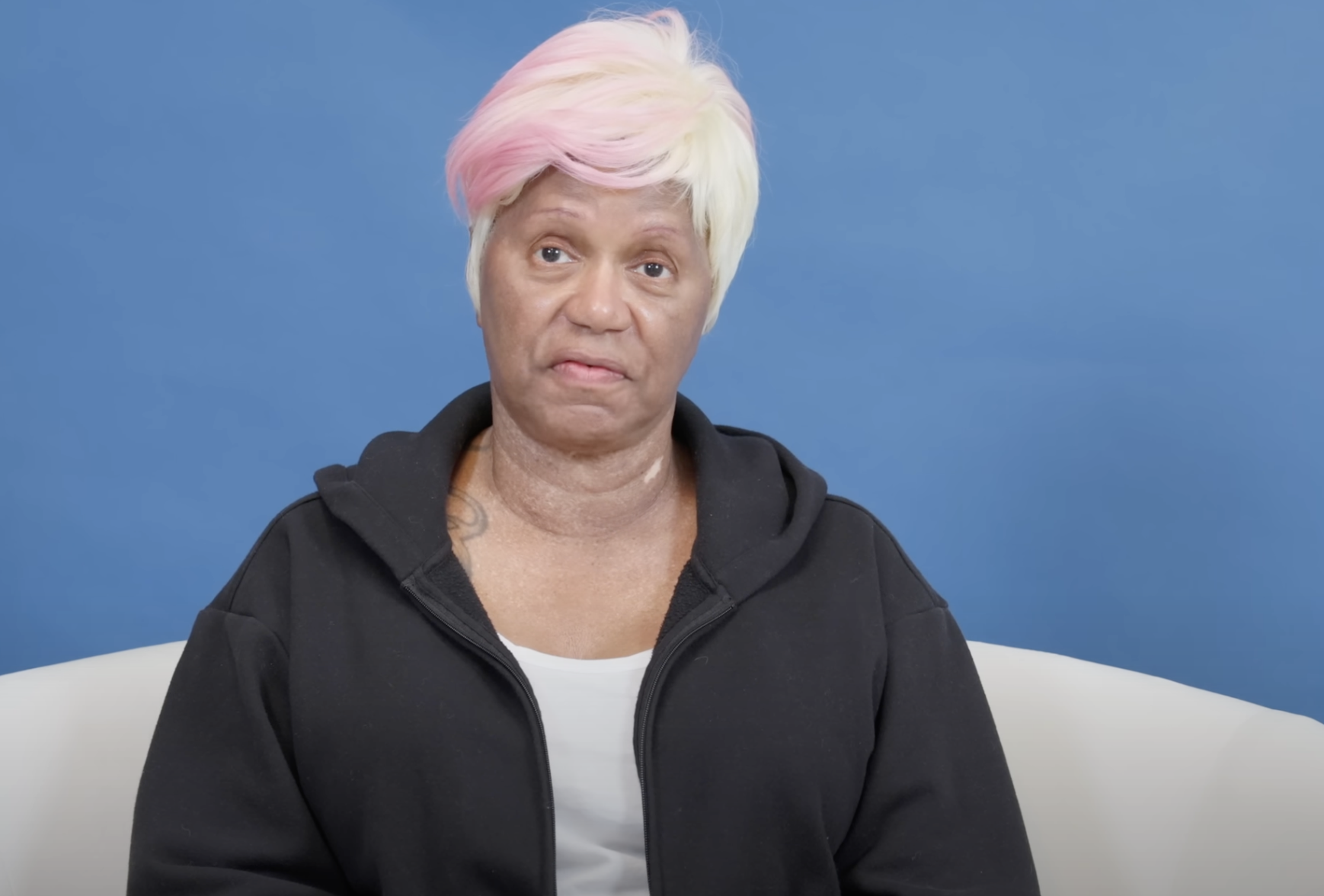 Diana antes de su rejuvenecimiento facial, fechada el 23 de agosto de 2024 | Fuente: YouTube/@Dr.Truesdale