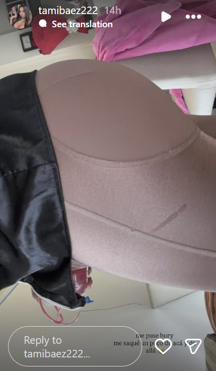 Tamara Báez mostrando los resultados de sus cirugías y su recuperación | Fuente: Instagram Stories/tamibaez222