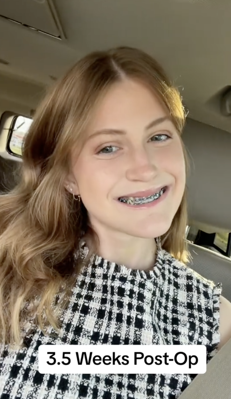 Virginia Elder sonríe ampliamente, con los aparatos dentales aún visibles pero la hinchazón casi desaparecida | Fuente: TikTok/virginiaeelder