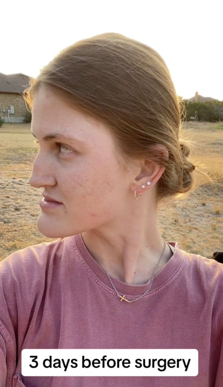 Virginia Elder se gira hacia la derecha, mostrando la forma de su mandíbula natural | Fuente: TikTok/virginiaeelder