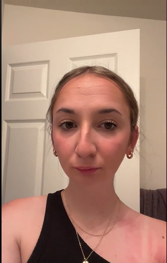 A screenshot of TikToker Maddie antes de someterse a una operación de doble mandíbula de un post fechado el 2 de agosto de 2023. | Fuente: TikTok/maddieakamofo