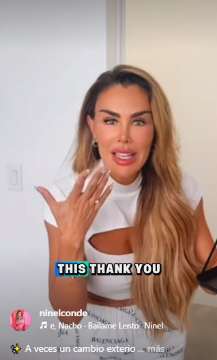 Ninel Conde mostrando su nuevo color de ojos, después de la cirugía. | Fuente: Instagram/@ninelconde