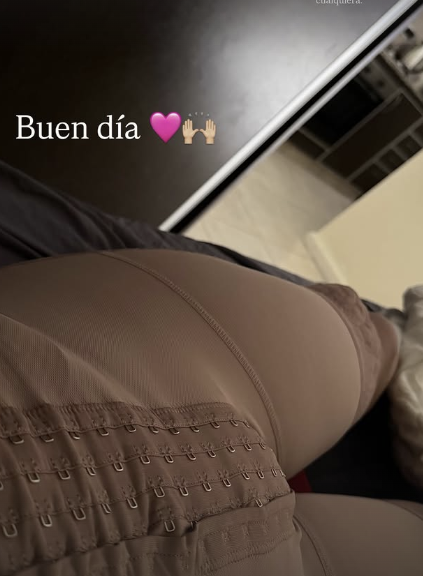 Tamara Báez mostrando los resultados de sus cirugías y su recuperación | Fuente: Instagram Stories/tamibaez222