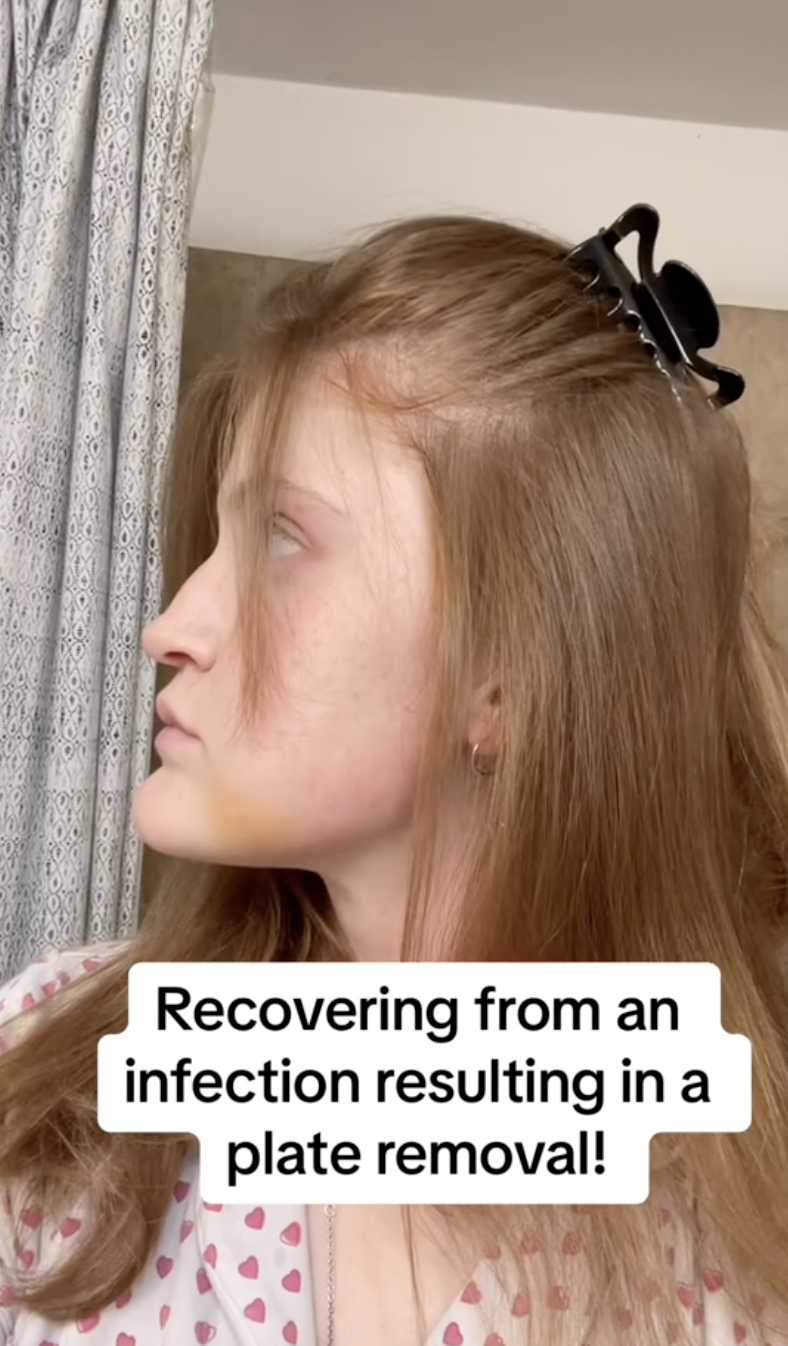 Virginia Elder está sentada de perfil, con expresión neutra mientras se desvanece la decoloración | Fuente: TikTok/virginiaeelder