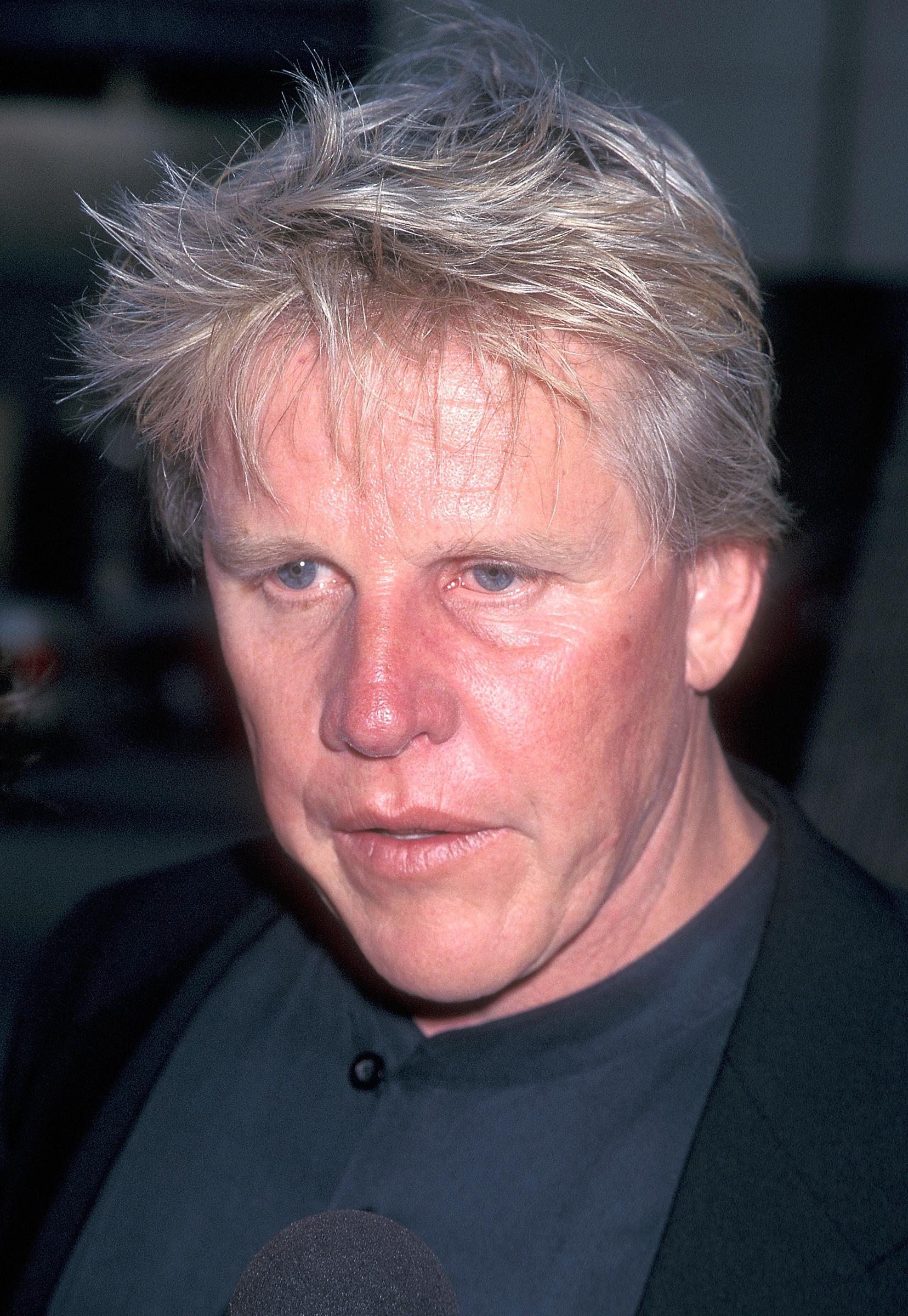 La enfermedad dio lugar a una intervención facial que acabó cambiando el aspecto físico de Gary Busey. | Fuente: Getty Images