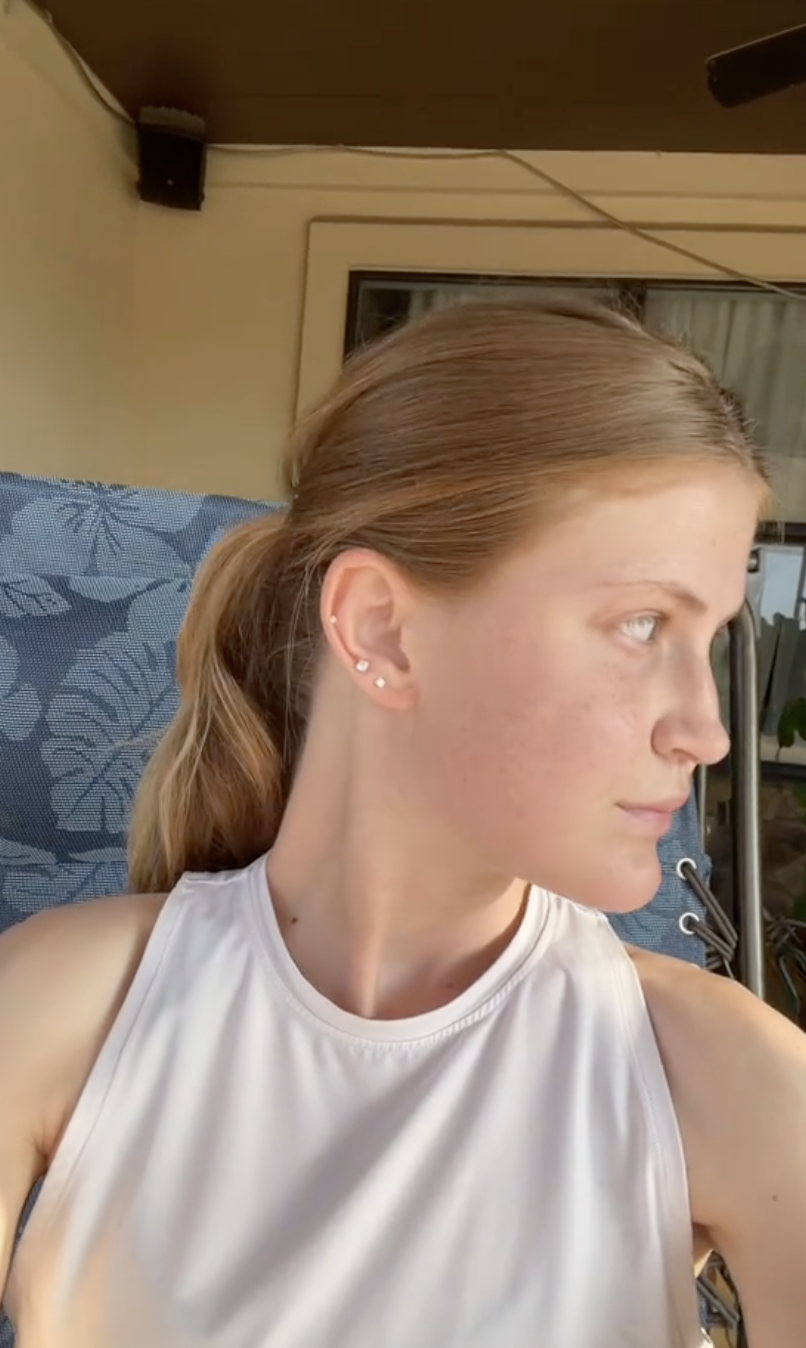 Virginia Elder mira a un lado mientras está sentada al aire libre, mostrando signos de curación constante | Fuente: TikTok/virginiaeelder