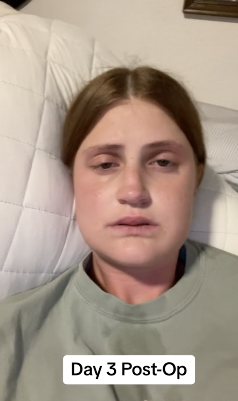 Virginia Elder está sentada en su casa, con las mejillas hinchadas y los ojos llorosos, navegando por la recuperación | Fuente: TikTok/virginiaeelder