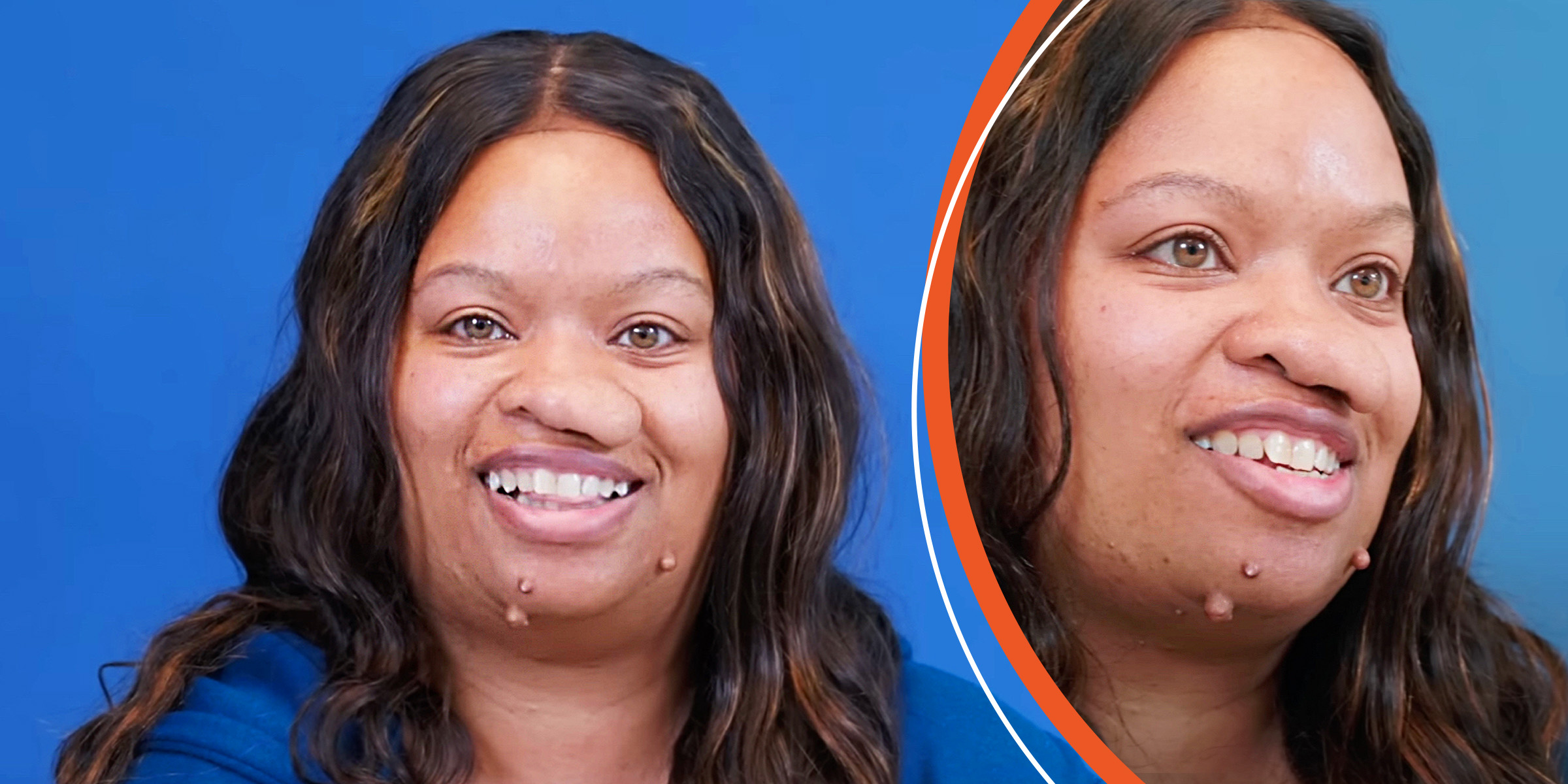 La mujer con tumores faciales | Fuente: YouTube/@Dr.Truesdale