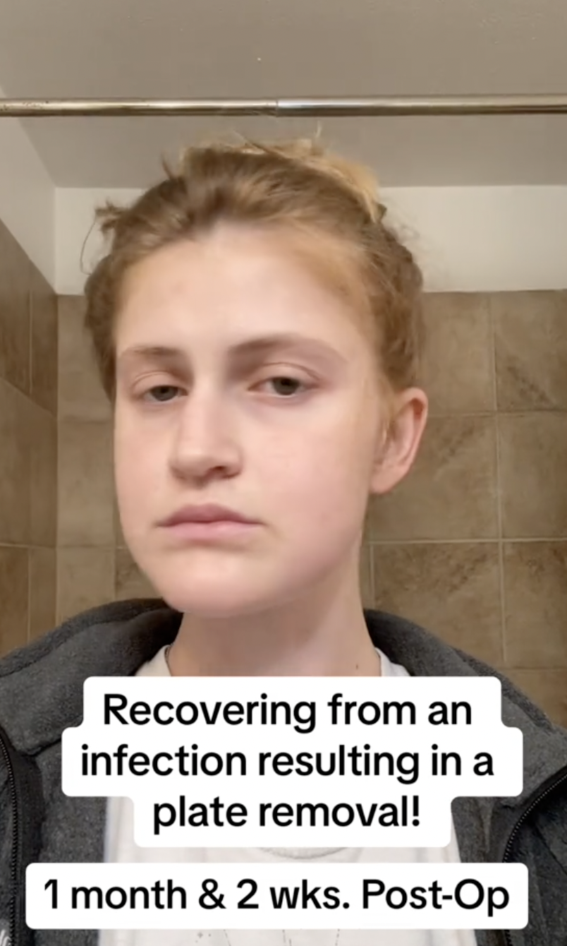 Virginia Elder parece apagada, recuperándose tras un contratiempo en la curación | Fuente: TikTok/virginiaeelder