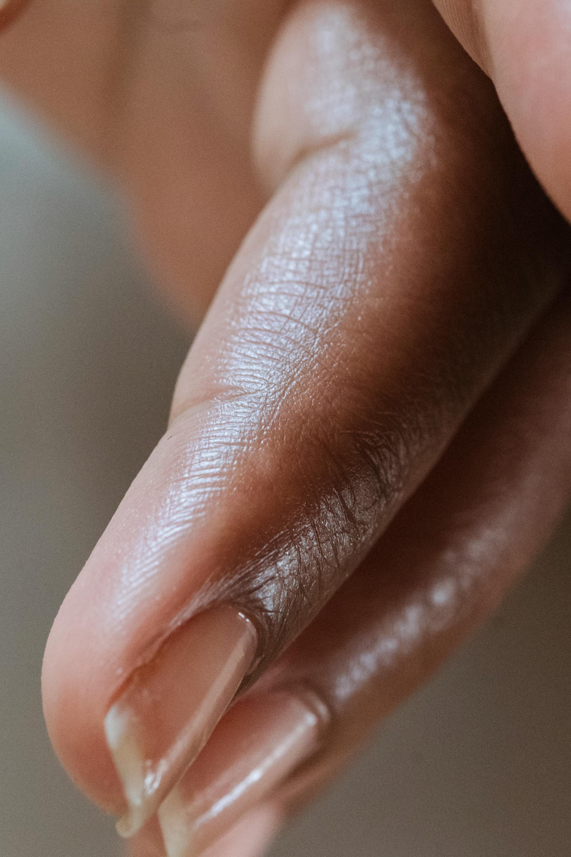 Image for illustrative purposes | Photo: Pexels