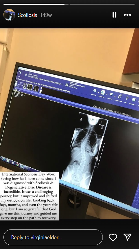 Virginia Elder reflexiona sobre su diagnóstico de escoliosis y su recuperación tras años de tratamiento y resiliencia guiada por la fe | Fuente: Instagram/virginiaelder