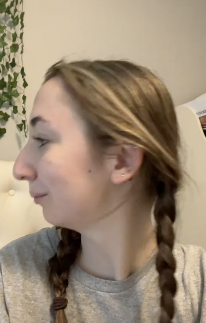 Una captura de pantalla de Maddie antes de someterse a una operación de doble mandíbula, de un post fechado el 24 de octubre de 2023. | Fuente: TikTok/maddieakamofo