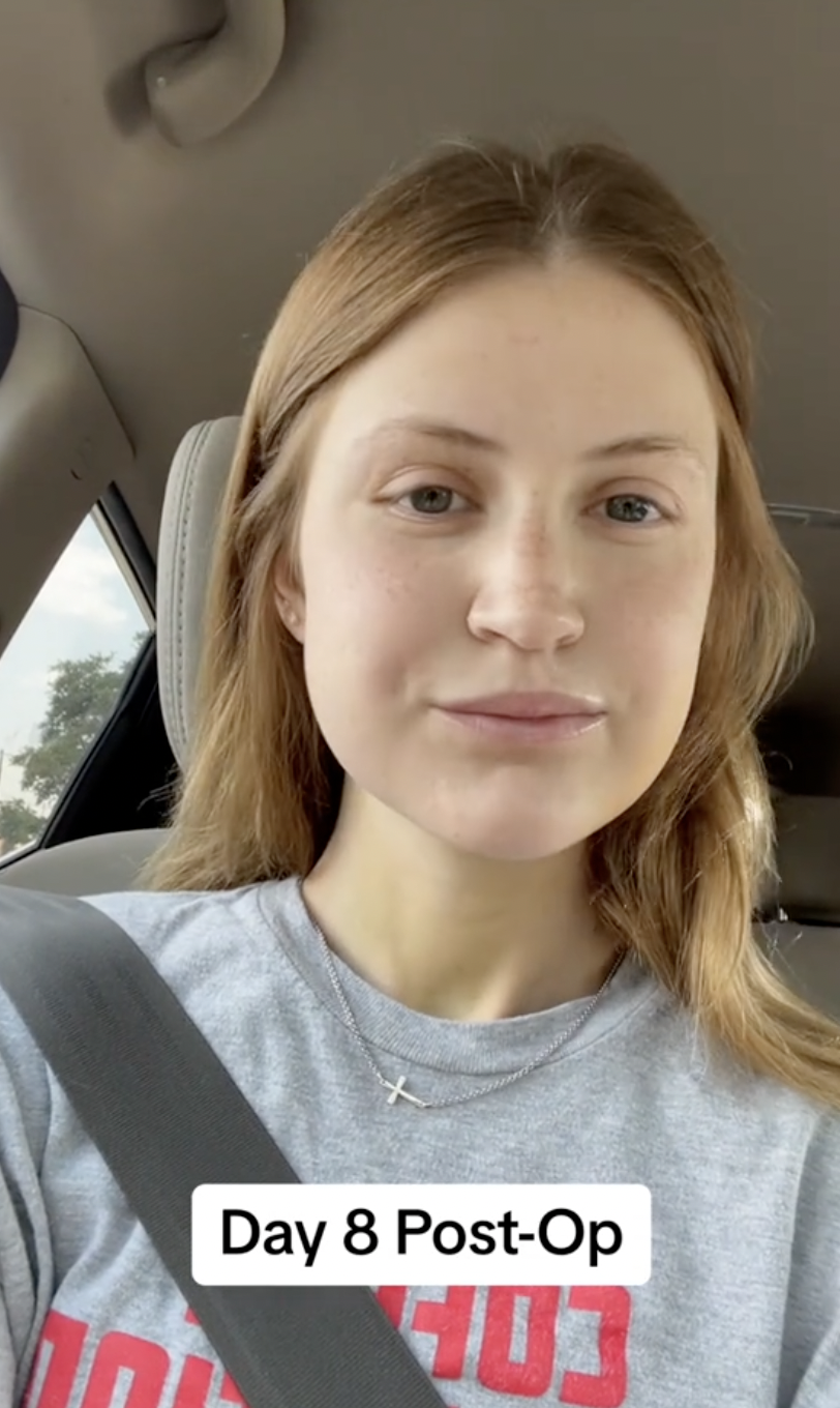 En el automóvil, Virginia Elder comparte su primer selfie público desde la operación | Fuente: TikTok/virginiaeelder