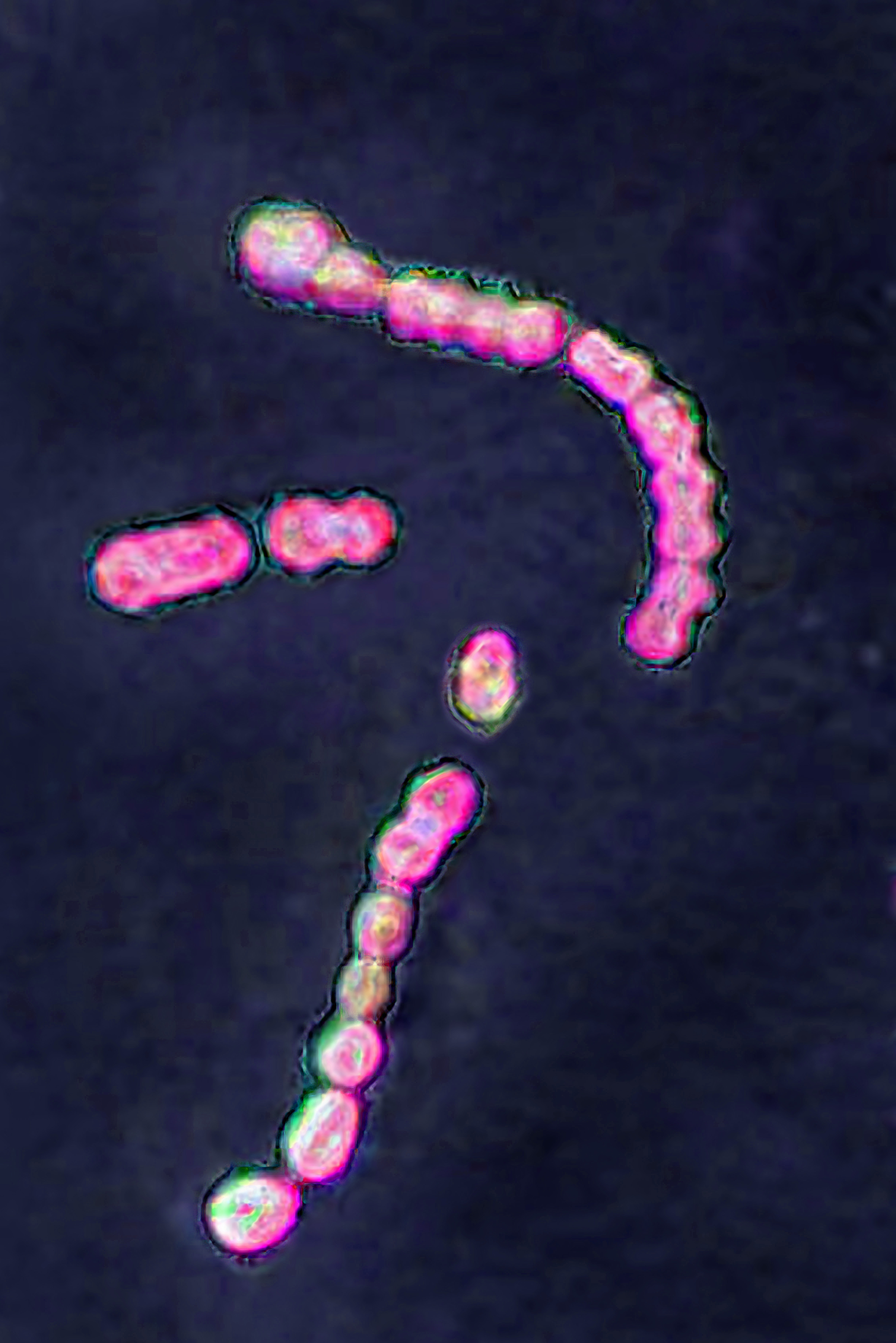 Imagen de Streptococcus pyogenes del grupo A, la bacteria relacionada con la faringitis estreptocócica y otras infecciones graves | Fuente: Getty Images