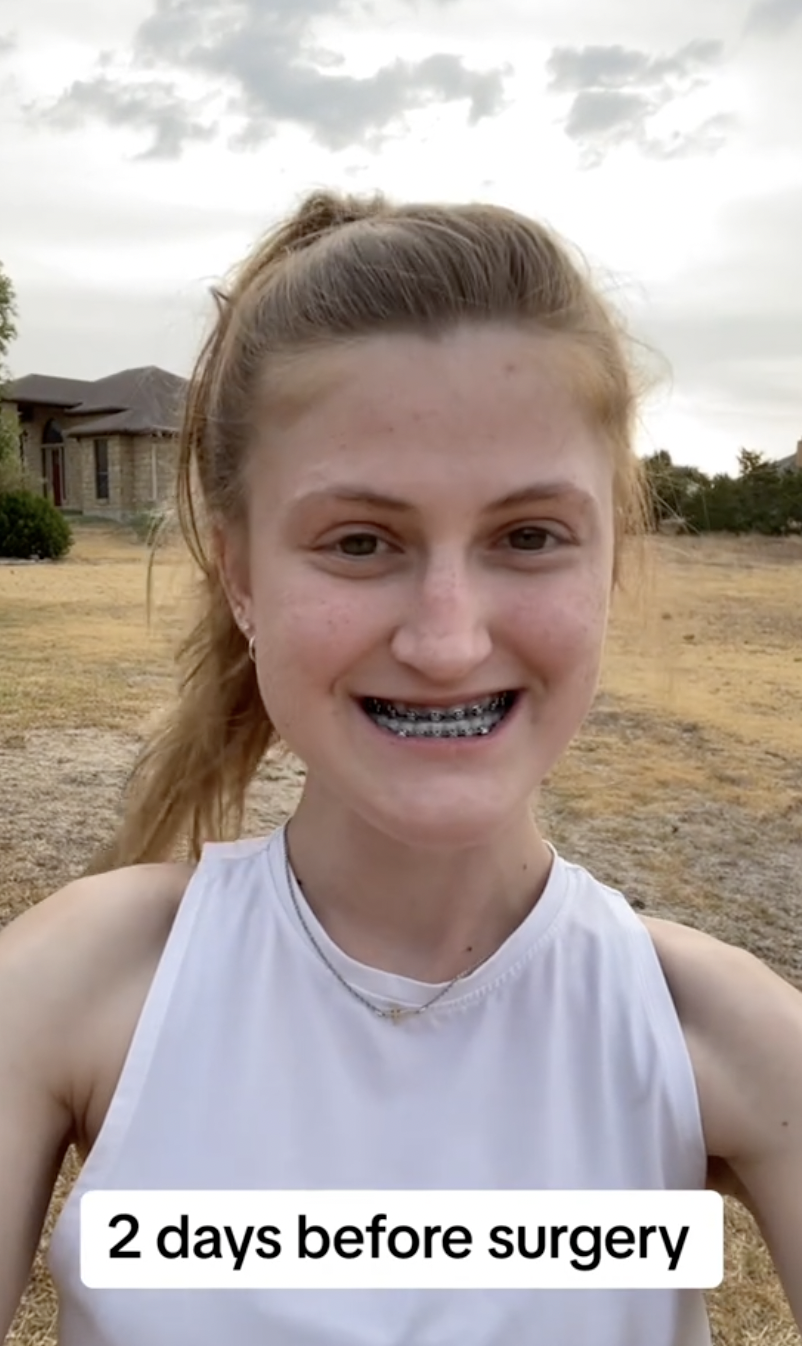 Virginia Elder sonríe para la cámara sólo dos días antes de someterse a una operación de doble mandíbula | Fuente: TikTok/virginiaeelder