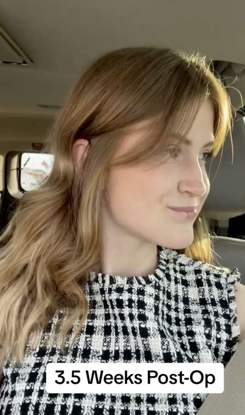 Virginia Elder mira a la derecha, mostrando el cambio en su mandíbula | Fuente: TikTok/virginiaeelder