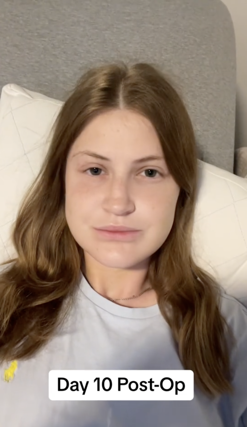 Virginia Elder descansando en casa 10 días después de la operación, mostrando una expresión tranquila y serena | Fuente: TikTok/virginiaeelder