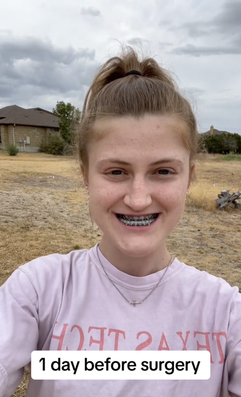 Un día antes de la operación, Virginia Elder documenta su último momento preoperatorio al aire libre y en camiseta | Fuente: TikTok/virginiaeelder