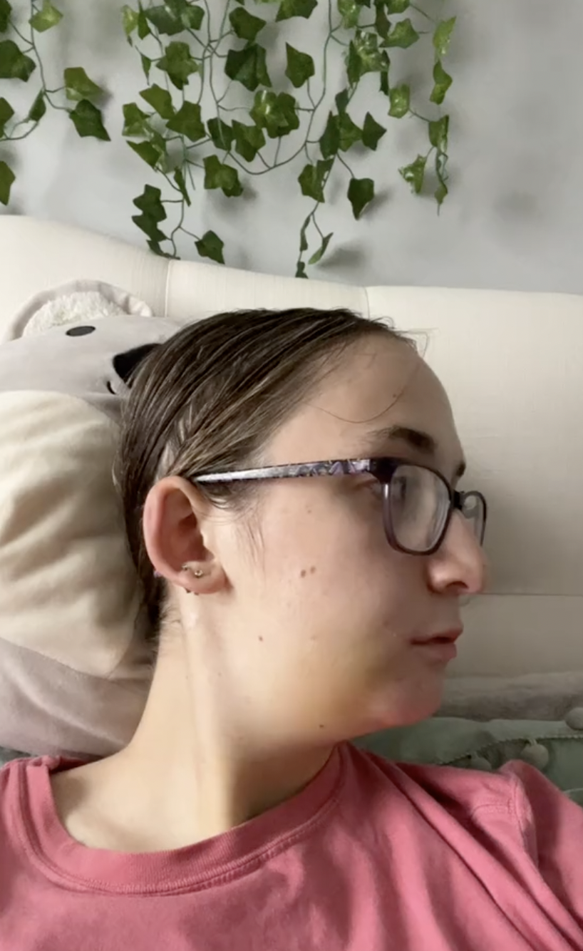 Captura de pantalla de Maddie curándose tras someterse a una operación de doble mandíbula, de un post fechado el 24 de octubre de 2023. | Fuente: TikTok/maddieakamofo