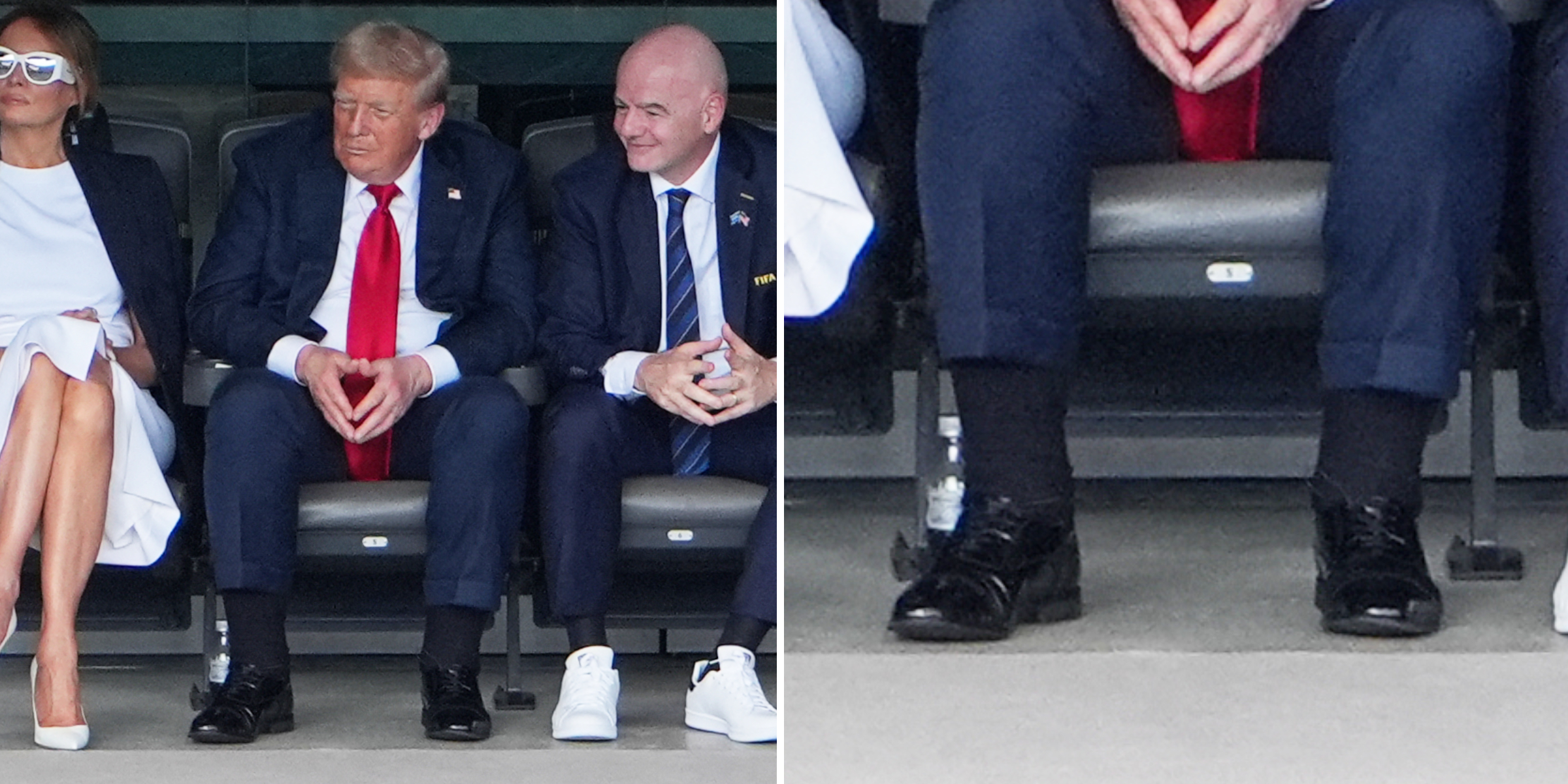 Primer plano de las piernas hinchadas del presidente Donald Trump durante el partido de la final de la Copa Mundial de Clubes de la FIFA 2025 entre el PSG y el Chelsea en el estadio Met Life el 13 de julio de 2025 en Nueva Jersey | Fuente: Getty Images