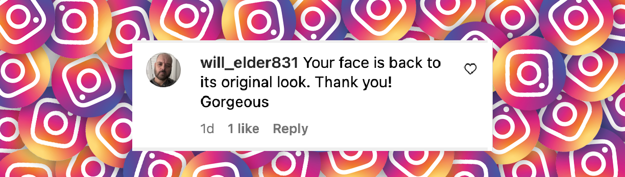 Un comentario de un fan fechado el 14 de mayo de 2025: "Tu rostro volvió a lucir como era en un principio. ¡Gracias! Hermoso" | Fuente: Instagram/zacefron
