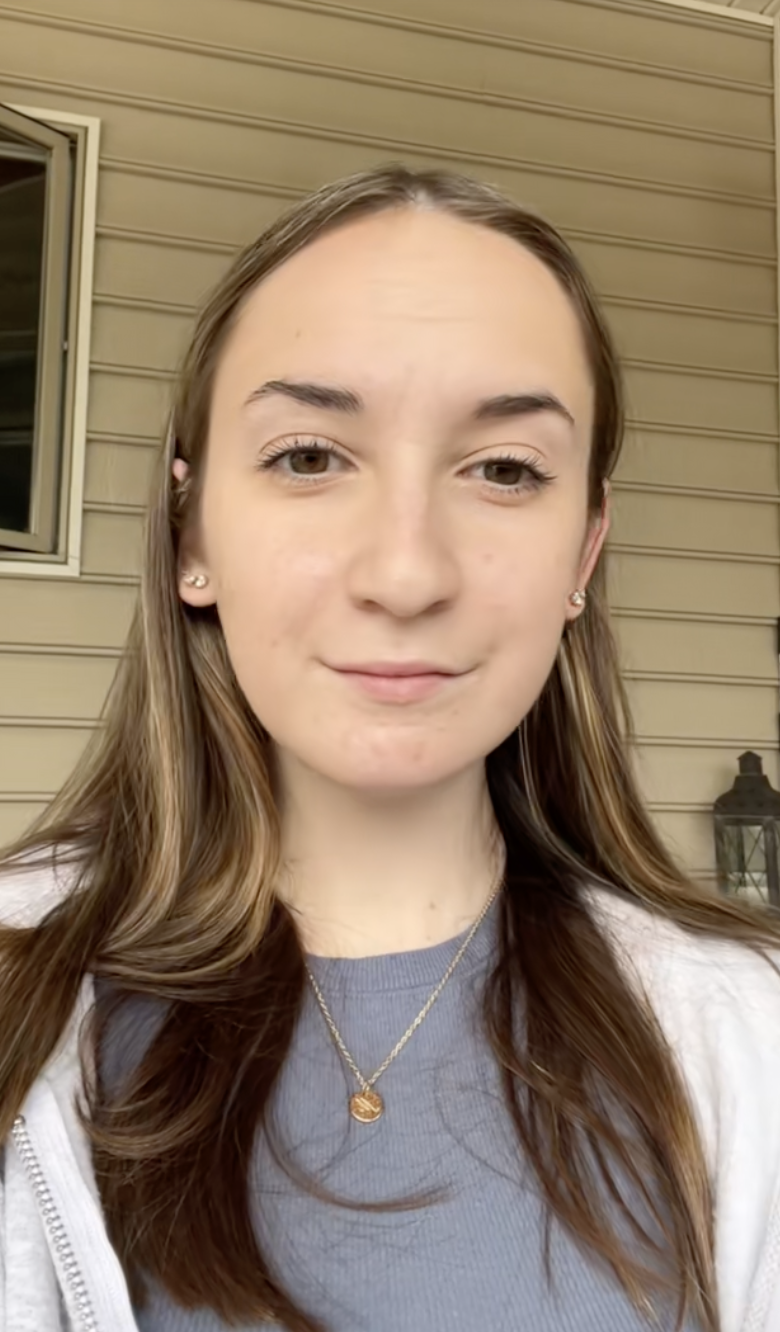A screenshot of Maddie tras someterse a una operación de doble mandíbula de un post fechado el 2 de agosto de 2023. | Fuente: TikTok/maddieakamofo