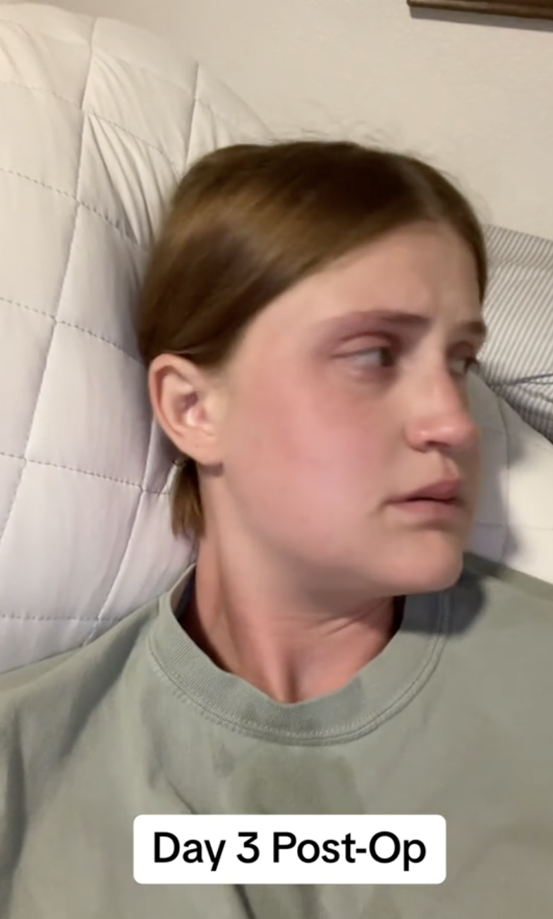 Desde otro ángulo, la distensión facial de Virginia Elder sigue siendo evidente mientras se recupera en casa | Fuente: TikTok/virginiaeelder