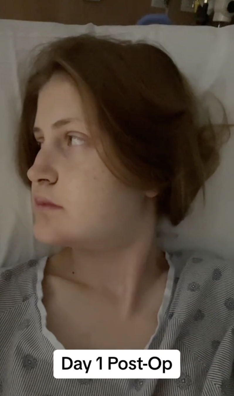 Un vistazo lateral en el Día 1 del postoperatorio revela el grado de hinchazón y fatiga en la recuperación de Virginia Elder | Fuente: TikTok/virginiaeelder