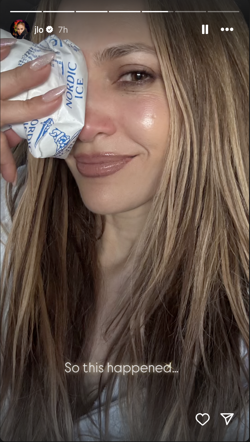 Jennifer Lopez colocándose hielo, publicado en sus historias de Instagram el 13 de mayo de 2025 | Fuente: Instagram/jlo